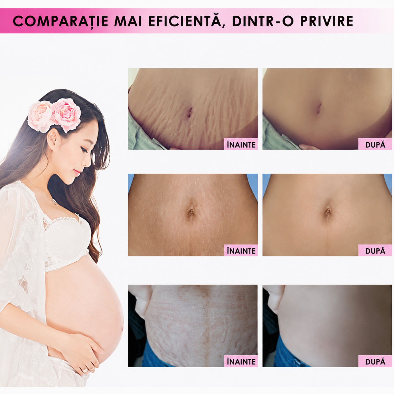 Cremă Minune pentru Vergeturi